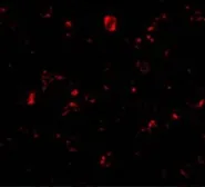 Anti-MTBP antibody used in Immunocytochemistry/ Immunofluorescence (ICC/IF). GTX31662