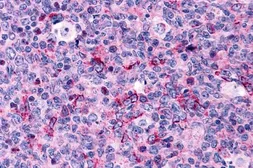 Anti-Caspase 3 antibody used in IHC (Paraffin sections) (IHC-P). GTX31698
