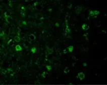 Anti-Rheb antibody used in IHC (Paraffin sections) (IHC-P). GTX31713