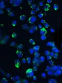 Anti-4E-BP1 antibody used in Immunocytochemistry/ Immunofluorescence (ICC/IF). GTX31714