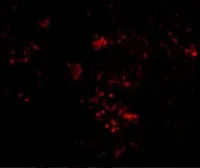 Anti-PAK2 antibody used in IHC (Paraffin sections) (IHC-P). GTX31742