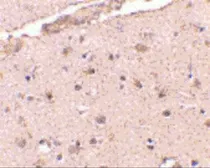 Anti-BRCC36 antibody used in IHC (Paraffin sections) (IHC-P). GTX31765