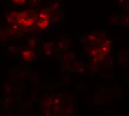 Anti-DYRK2 antibody used in Immunocytochemistry/ Immunofluorescence (ICC/IF). GTX31833