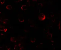 Anti-PHLPP2 antibody used in Immunocytochemistry/ Immunofluorescence (ICC/IF). GTX31862