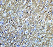 Anti-FOXA2 antibody used in IHC (Paraffin sections) (IHC-P). GTX31875
