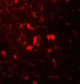 Anti-beta 2 Microglobulin antibody used in IHC (Paraffin sections) (IHC-P). GTX31884