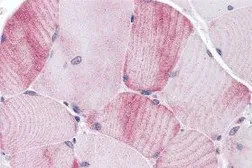 Anti-MYBPC1 antibody used in IHC (Paraffin sections) (IHC-P). GTX31984