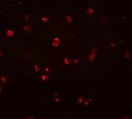 Anti-NLRC3 antibody used in Immunocytochemistry/ Immunofluorescence (ICC/IF). GTX31989