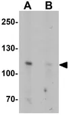 Anti-ATP2C2 antibody used in Western Blot (WB). GTX32009