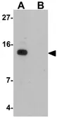 Anti-DDA1 antibody used in Western Blot (WB). GTX32030