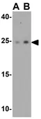 Anti-SPATA19 antibody used in Western Blot (WB). GTX32045