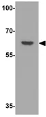 Anti-MEX3B antibody used in Western Blot (WB). GTX32049