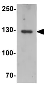 Anti-MYBPC1 antibody used in Western Blot (WB). GTX32053