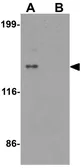 Anti-ZNF521 antibody used in Western Blot (WB). GTX32072