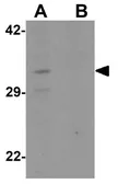 Anti-CLEC2A antibody used in Western Blot (WB). GTX32085