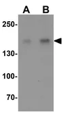 Anti-CRIM2 antibody used in Western Blot (WB). GTX32086