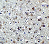 Anti-PLAGL2 antibody used in IHC (Paraffin sections) (IHC-P). GTX32095