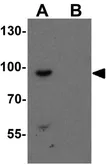 Anti-SHROOM1 antibody used in Western Blot (WB). GTX32098