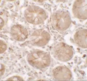 Anti-SHISA3 antibody used in IHC (Paraffin sections) (IHC-P). GTX32109