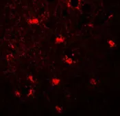 Anti-LC3C antibody used in IHC (Paraffin sections) (IHC-P). GTX32125