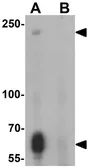 Anti-TOPAZ1 antibody used in Western Blot (WB). GTX32132