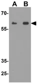 Anti-KIRREL3 antibody used in Western Blot (WB). GTX32140