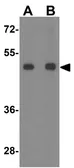 Anti-SLC29A3 antibody used in Western Blot (WB). GTX32151