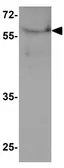 Anti-PALMD antibody used in Western Blot (WB). GTX32160