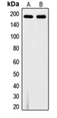 Anti-VEGF Receptor 1 (phospho Tyr1213) antibody used in Western Blot (WB). GTX32184