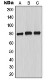 Anti-MARCKS (phospho Ser156) antibody used in Western Blot (WB). GTX32212