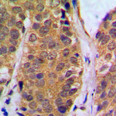 Anti-NFkB p105 (phospho Ser927) antibody used in IHC (Paraffin sections) (IHC-P). GTX32222