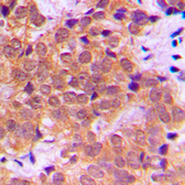 Anti-NFkB p65 (phospho Ser468) antibody used in IHC (Paraffin sections) (IHC-P). GTX32256