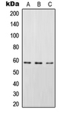 Anti-STAM2 (phospho Tyr192) antibody used in Western Blot (WB). GTX32284