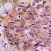 Anti-SMAD3 (phospho Ser425) antibody used in IHC (Paraffin sections) (IHC-P). GTX32335