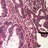 Anti-Bad (phospho Ser112) antibody used in IHC (Paraffin sections) (IHC-P). GTX32370