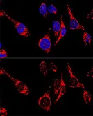Anti-AIF antibody used in Immunocytochemistry/ Immunofluorescence (ICC/IF). GTX32428