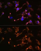 Anti-Amphiphysin antibody used in Immunocytochemistry/ Immunofluorescence (ICC/IF). GTX32438