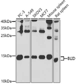 Anti-BRCC2 antibody used in Western Blot (WB). GTX32477