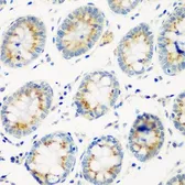 Anti-Cathepsin G antibody used in IHC (Paraffin sections) (IHC-P). GTX32491
