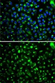 Anti-CYP2E1 antibody used in Immunocytochemistry/ Immunofluorescence (ICC/IF). GTX32546