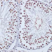 Anti-DNMT3L antibody used in IHC (Paraffin sections) (IHC-P). GTX32565