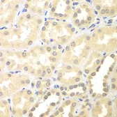Anti-DTX2 antibody used in IHC (Paraffin sections) (IHC-P). GTX32566