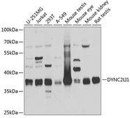 Anti-DYNC2LI1 antibody used in Western Blot (WB). GTX32569