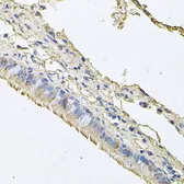 Anti-EPO receptor antibody used in IHC (Paraffin sections) (IHC-P). GTX32590