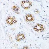 Anti-Fatty Acid Synthase antibody used in IHC (Paraffin sections) (IHC-P). GTX32598