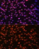 Anti-FRA1 antibody used in Immunocytochemistry/ Immunofluorescence (ICC/IF). GTX32609