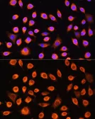 Anti-GNAS antibody used in Immunocytochemistry/ Immunofluorescence (ICC/IF). GTX32629