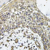 Anti-ICOS Ligand antibody used in IHC (Paraffin sections) (IHC-P). GTX32664