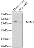 Anti-MTM1 antibody used in Western Blot (WB). GTX32731