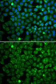 Anti-Nucleoporin p62 antibody used in Immunocytochemistry/ Immunofluorescence (ICC/IF). GTX32758